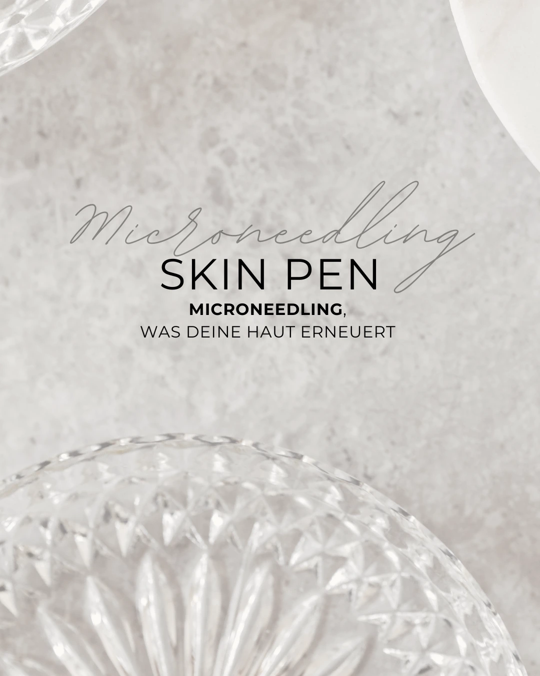SkinPen Microneedling – Motiv aus dem Royal-Relax-Archiv